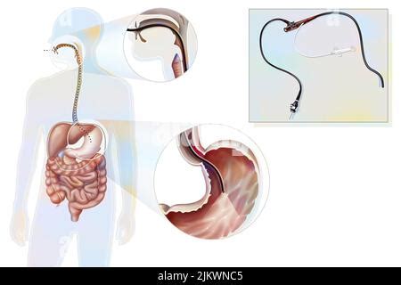 gastroscopy brentford|Locations .